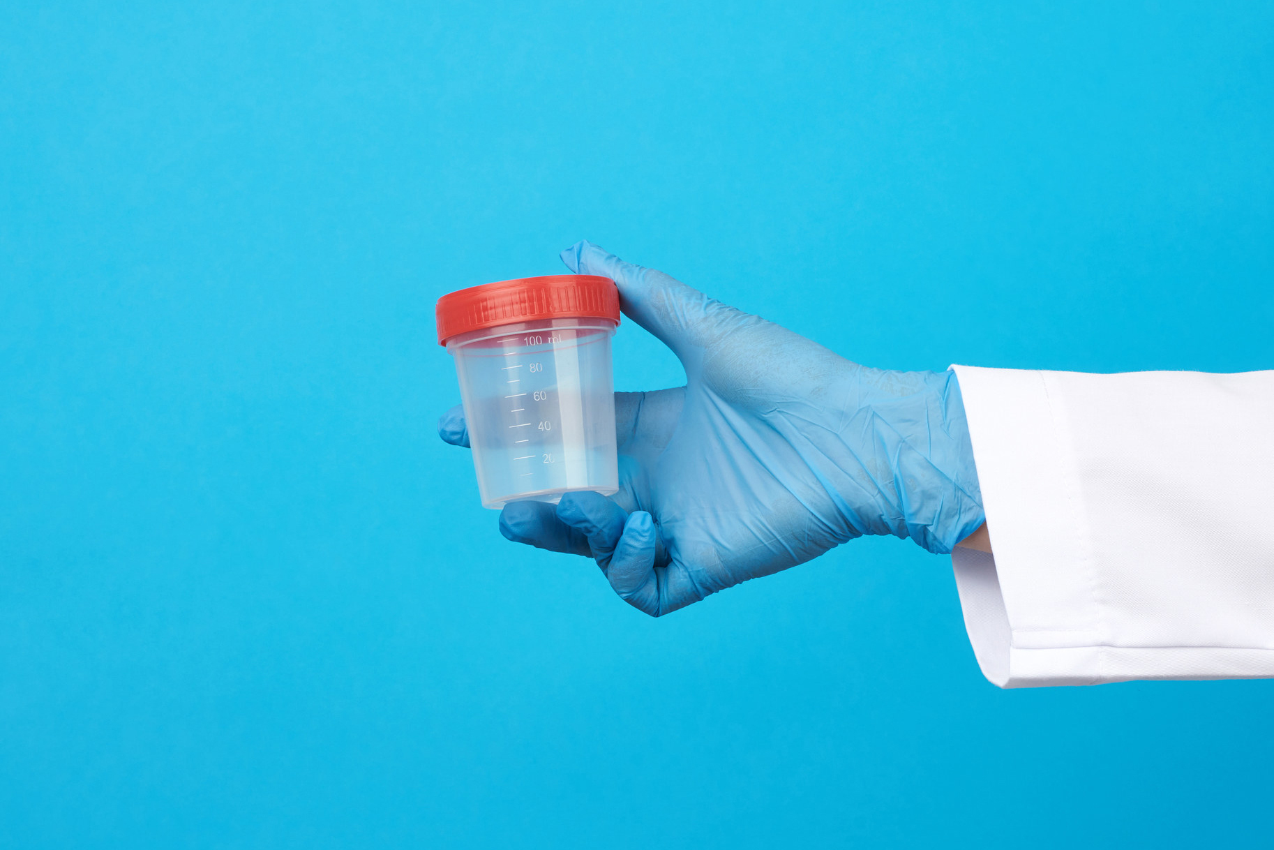 Автозавод: дополнительный адрес для кандидатов доноров спермы