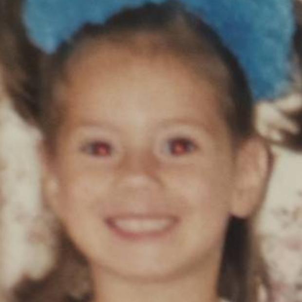 Фоторафия донора CMP-DO-3063