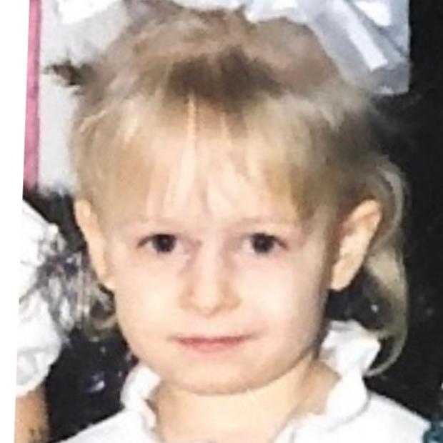 Фоторафия донора CMP-DO-3011