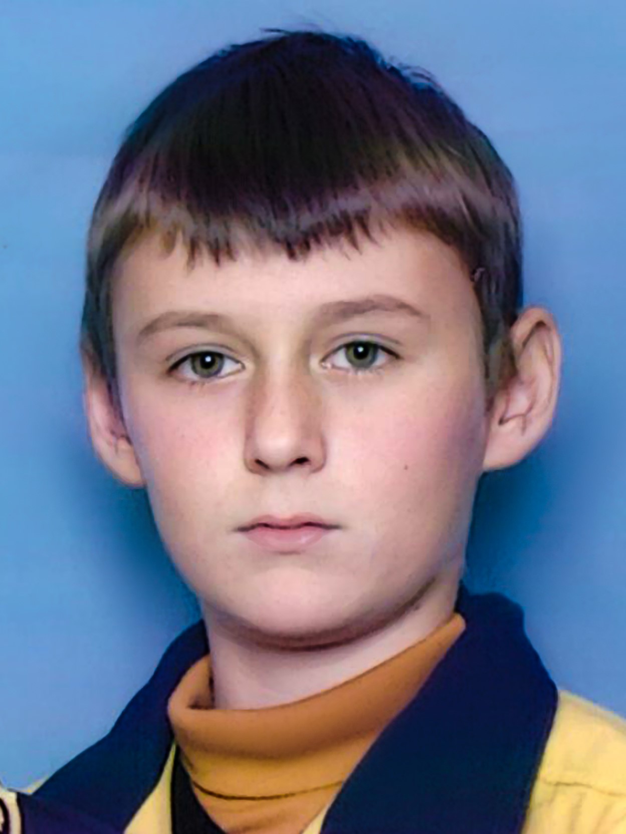 Фоторафия донора CMP-DS-2030